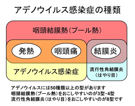 アデノウィルス感染症の種類